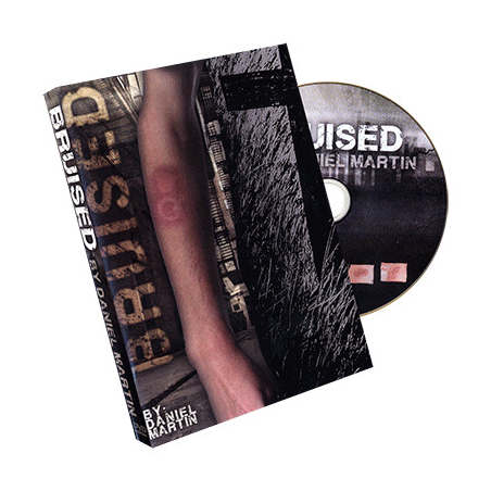 Bruised by Daniel Martin